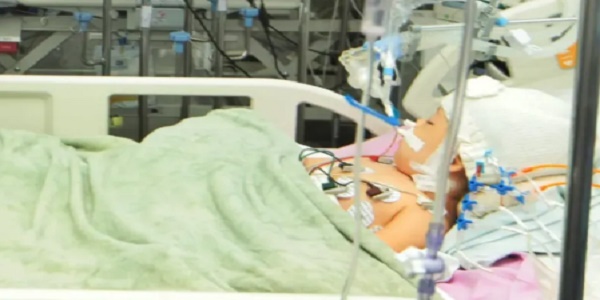 Hospital divulgou na noite desta quarta-feira novo boletim sobre estado de saúde Gêmeas siamesas