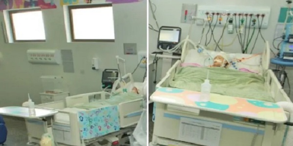 Siamesa separada é extubada depois de apresentar melhora