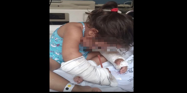 Criança de 4 anos vítima de agressão em Morrinhos se recupera bem após cirurgia
