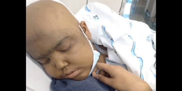 Adolescente de Morrinhos em tratamento pós-transplante de medula óssea precisa de ajuda urgente