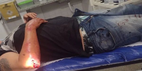 Motociclista se acidenta ao passar por quebra-molas em frente ao Fórum na Av. dos Trabalhadores