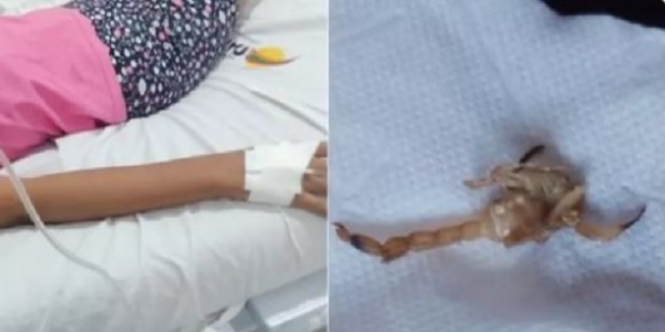 Criança é levada a hospital após ser atacada por escorpião dentro de casa .