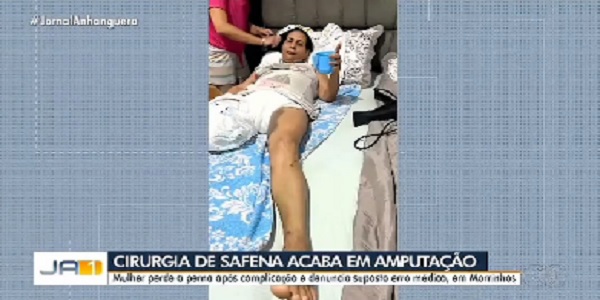 Mulher de Bela Vista perde a perna após cirurgia de safena em hospital conveniado ao SUS em Morrinhos. VÍDEO!